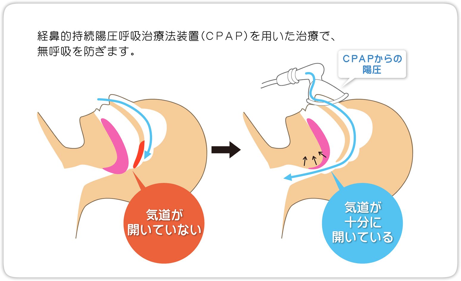 睡眠